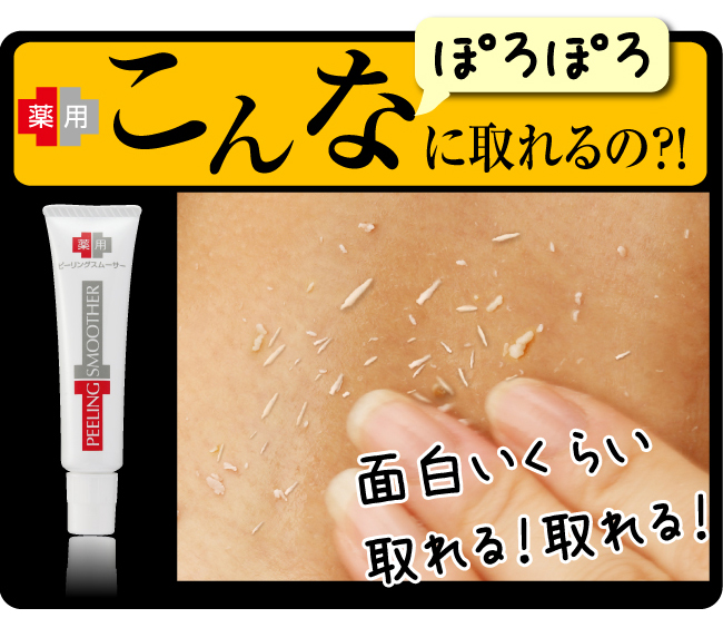 ps[OX[T[ - C[W摜
