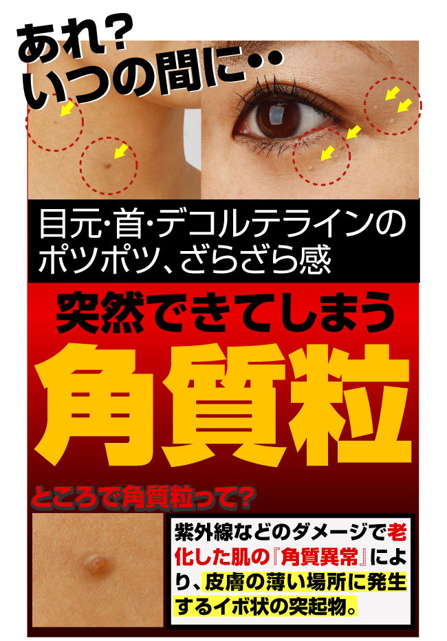 ps[OX[T[ - C[W摜